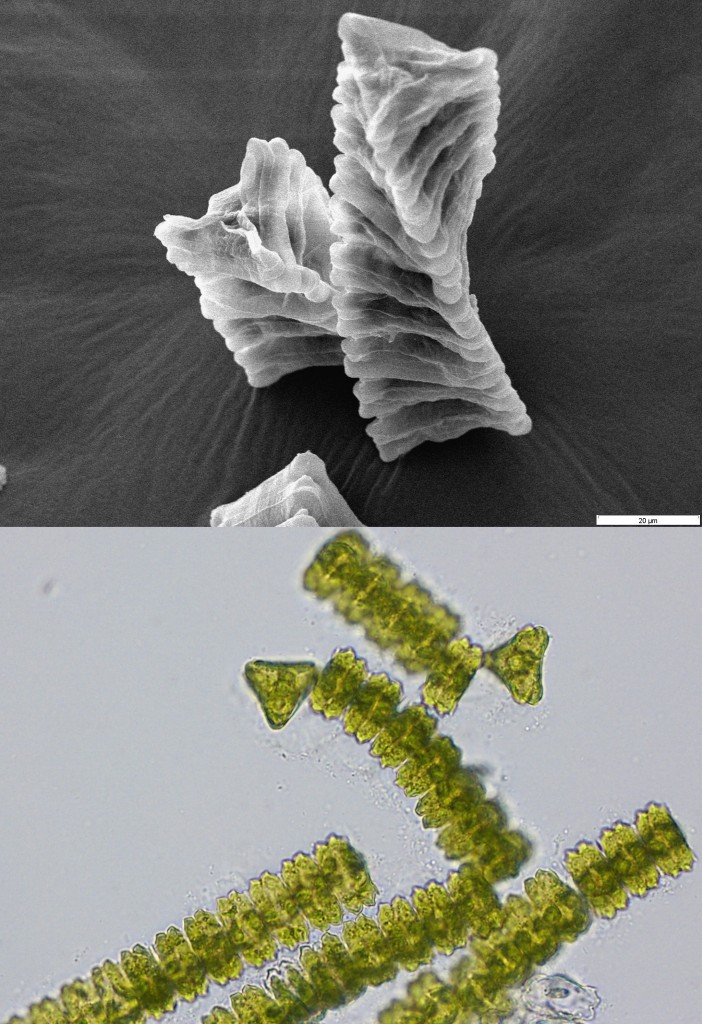 Elektronen- und Durchlichtmikroskopbilder einer Süßwasseralge der Gattung Desmidium