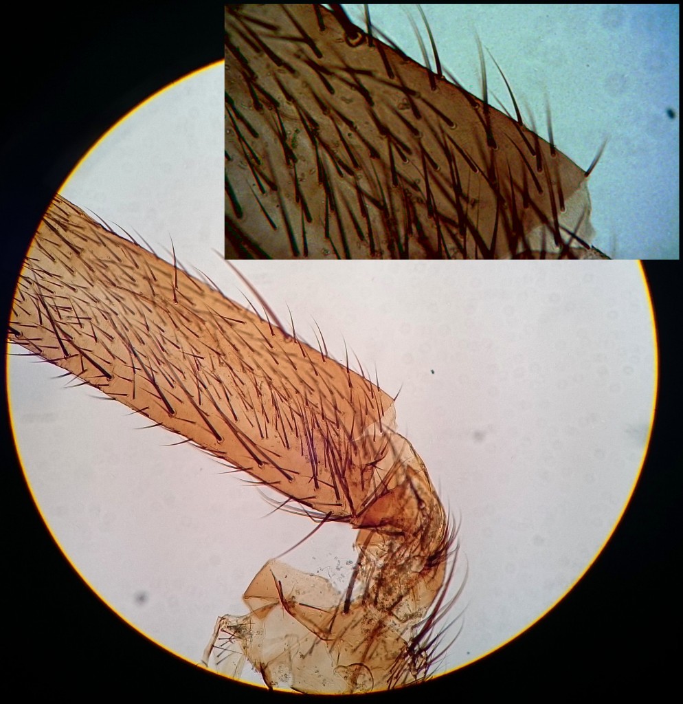 Vergleich: Fliegenbeinbilder auf Olympus Mikroskop, rechts oben Bresser Kamera, rundes Bild Mobiltelefon.