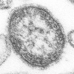 So sieht ein Masernvirus aus. Ob ihr es wahrhaben wollt oder nicht. Quelle: https://goo.gl/BQEiQe