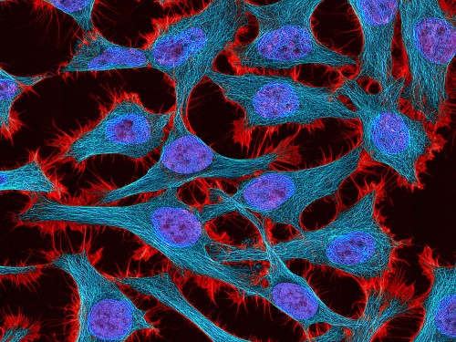 HeLa-Zellen unter dem Mikroskop. Zu sehen sind verschiedene Strukturproteine in Rot und Cyan sowie der Zellkern in blau. Bild: NIH, public domain.