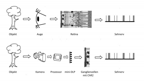Im gesunden Auge wird das von einem Objekt reflektierte Licht beim Eintritt ins Auge gebrochen und auf die Retina reflektiert. Photorezeptoren und Nervenzellen wandeln das Licht in einen elektrischen Impuls um der an das Gehirn weitergeleitet wird (oben). Bei einer Augenprothese übernimmt eine Kamera und ein Computerchip die Bildaufnahme und -prozessierung. Die errechnete Impulsfolge wird mittels einer Photodiode an modifizierte Ganglienzellen übertragen, die das Lichtsignal in einen elektrischen Impuls umwandeln (unten). (Retinaabbildung abgeändert übernommen von Wikimedia, CC BY-SA 3.0)