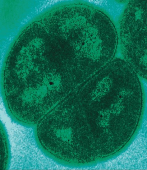 Bakterien der Art Deinococcus radiodurans, welche hohe Dosen von isolierender Strahlung überleben können.( Urheber: Laboratory of Michael Daly, Uniformed Services University, Bethesda, MD, USA.  , Bildrechte: public domain)