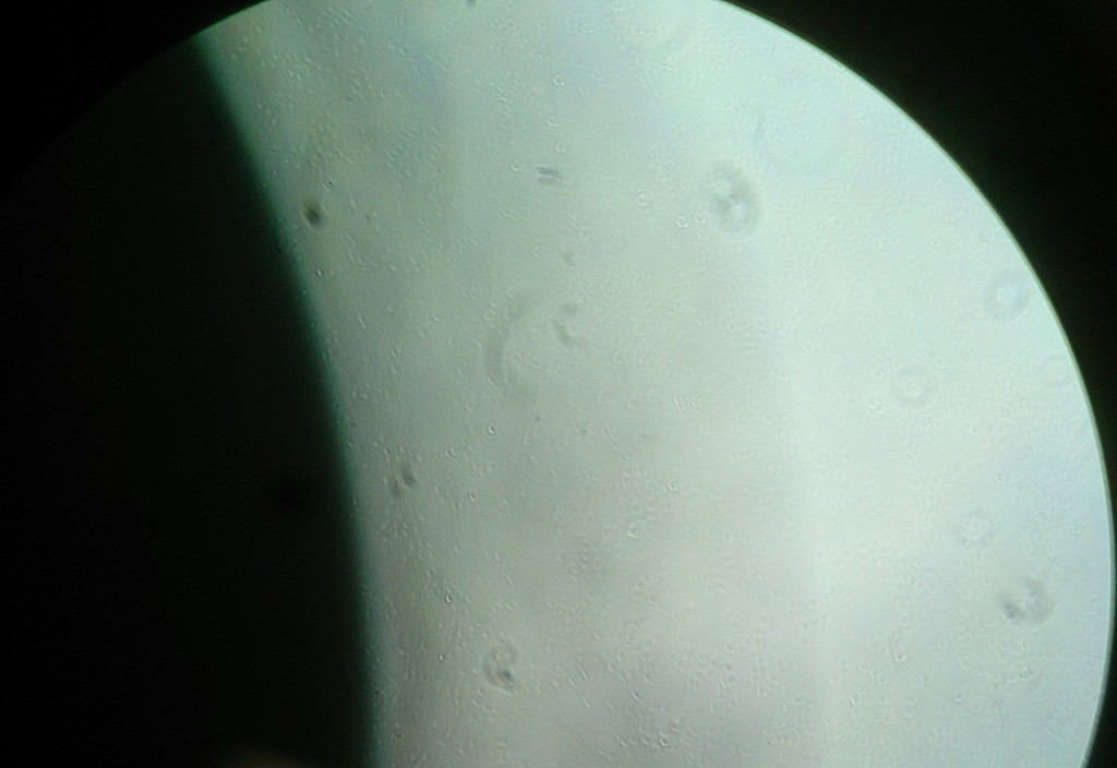 Bild aus einem Phasenkontrastmikroskop. Links der Umriss der Ein-Cent-Münze. Die schwachen, hellen Punkte am Rand des Münz-Schattens sind die Zellen, die größeren, dunklen Flecken sind lediglich Staubkörnchen irgendwo auf einer Linse. (Bild: CC-BY 4.0 André Lampe)