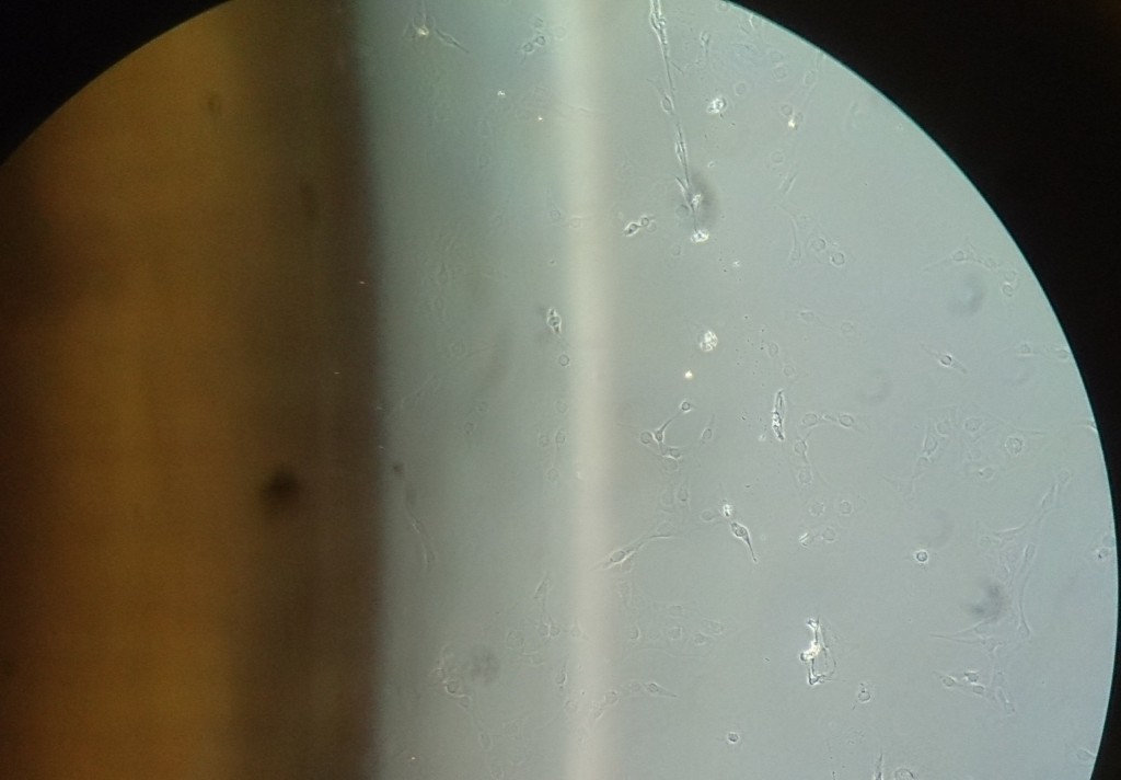 Bild aus dem Phasenkontrastmikroskop. Links wieder die Münze. Rechts kann man schon deutlicher Zellen erkennen. Phasenkontrast (dunkler) und Dunkelfeld (heller) spielen hier zusammen. (Bild: CC-BY 4.0 André Lampe)
