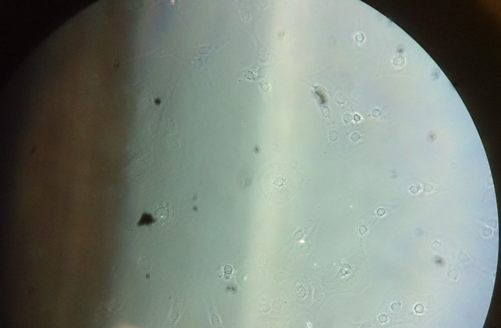 Bild aus dem Phasenkontrastmikroskop. Links die Münze, wegen der höheren Vergrößerung erscheint die Münze unschärfer als vorher. Die Zellen sind deutlicher zu erkennen. (Bild: CC-BY 4.0 André Lampe)