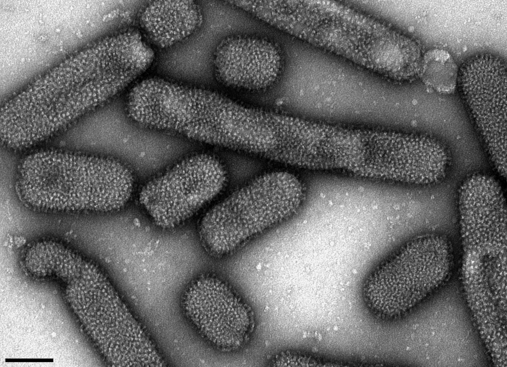 Influenza A Viren, Maßstab = 100 nm. (Bild: Norbert Bannert, Lars Möller/RKI, Weitere Infos zu den Bildrechten hier)