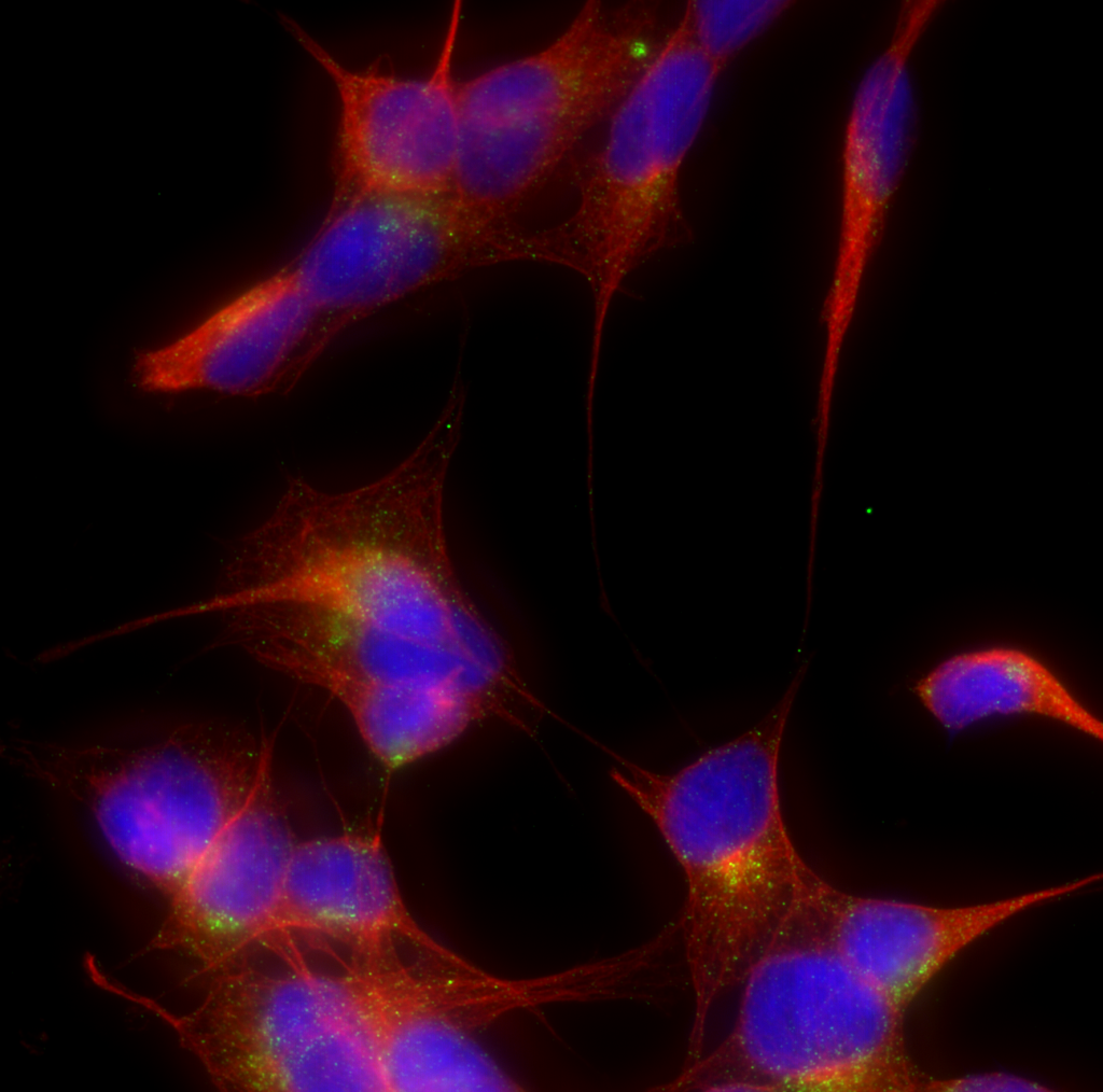 Fluoreszenzmikroskopische Aufnahme von SH-SY5Y Zellen, in blau der Zellkern, in grün Clathrin-bedeckte Vesikel und in rot Mikrotubuli.