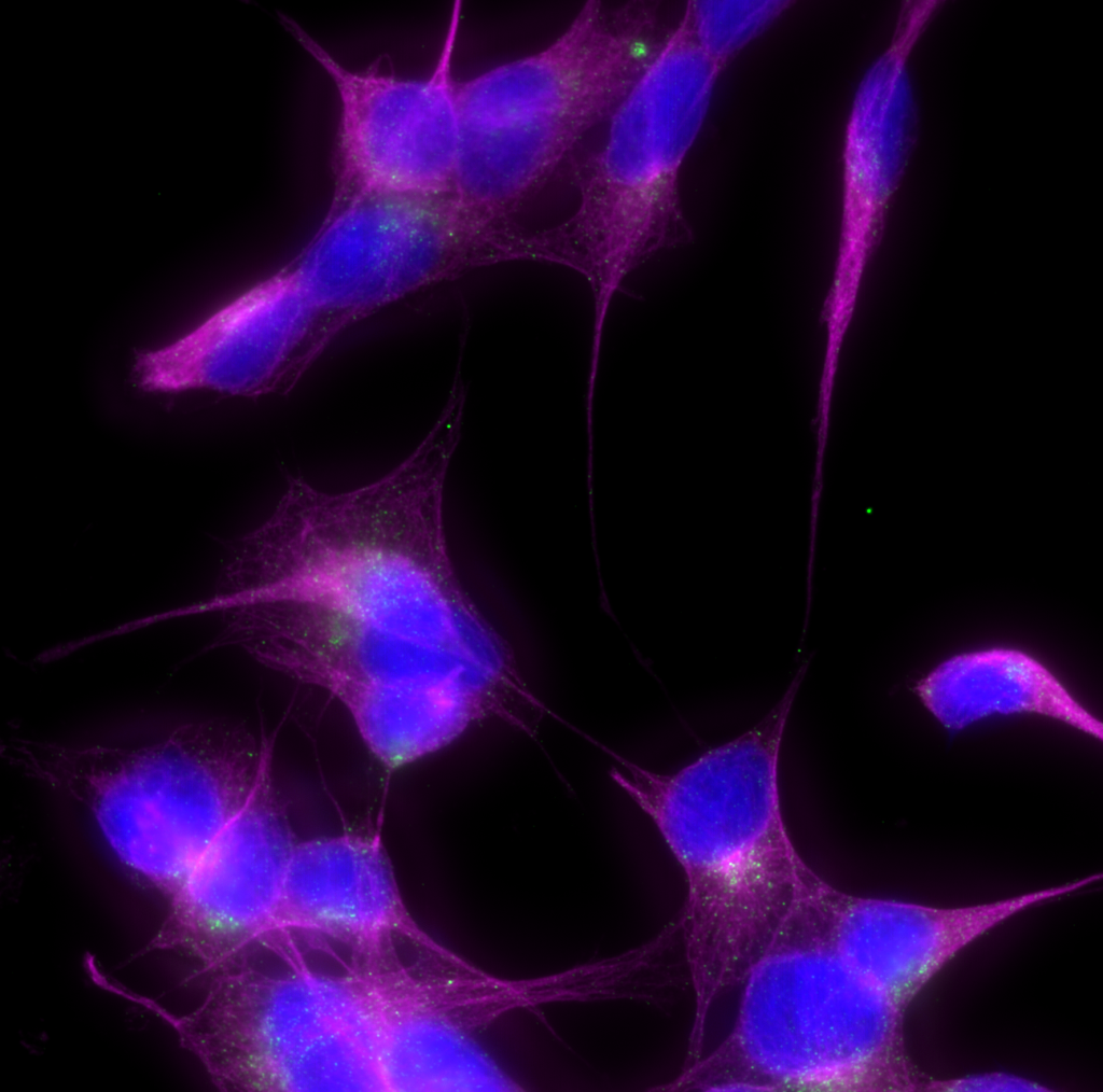 Fluoreszenzmikroskopische Aufnahme von SH-SY5Y Zellen, in blau der Zellkern, in grün Clathrin-bedeckte Vesikel und in magenta Mikrotubuli. Anklicken für große Version (1776x1760 Pixel).